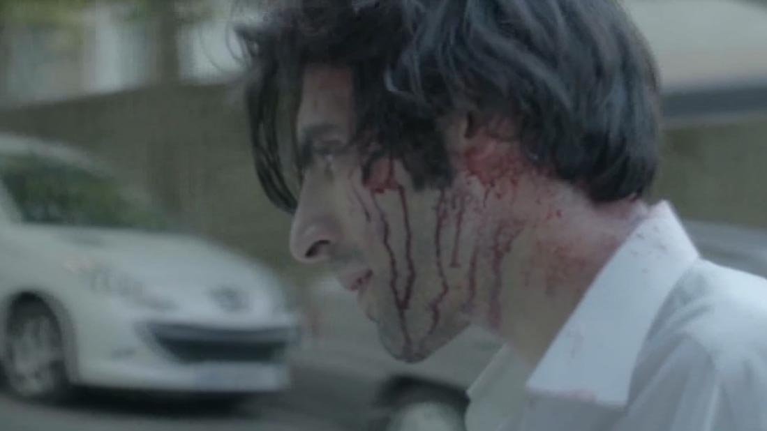 اکستریم (جزیره گنج)-هاشور